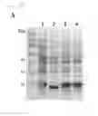 Fig. 25 - Universal protein overexpression tag comprising ramp function, and application thereof