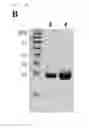 Fig. 26 - Universal protein overexpression tag comprising ramp function, and application thereof