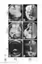 Fig. 08 - SELECTABLE MARKER FOR TRANSGENIC PLANTS
