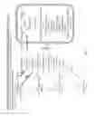 Fig. 08 - Tissue specific reduction of lignin