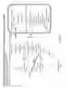 Fig. 11 - Tissue specific reduction of lignin