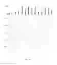 Fig. 32 - Methylation pattern analysis of tissues in a DNA mixture