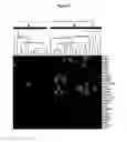Fig. 02 - METHOD FOR PROGNOSING THE SURVIVAL OF PATIENTS SUFFERING FROM CHRONIC MYELOMONOCYTIC LEUKAEMIA