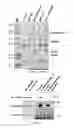 Fig. 06 - MARKER OF BREAST TUMORS FROM THE LUMINAL-B SUBTYPE