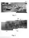 Fig. 02 - Localized hardening of metallic surfaces