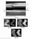 Fig. 09 - Heterogeneous material integration through guided lateral growth