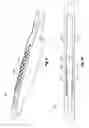 Fig. 07 - Spline insert for a downhole tool