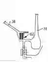 Fig. 01 - Brush seal repair method