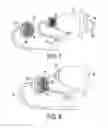 Fig. 06 - LED lighting fixture assembly