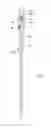 Fig. 55 - Shooting rests and pole assemblies