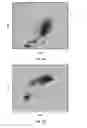 Fig. 04 - Basophil analysis system and method