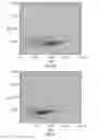 Fig. 07 - Nucleated red blood cell analysis system and method