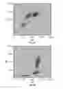 Fig. 08 - Nucleated red blood cell analysis system and method