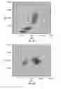 Fig. 09 - Nucleated red blood cell analysis system and method