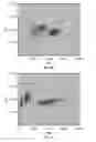 Fig. 10 - Nucleated red blood cell analysis system and method
