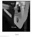 Fig. 62 - DESIGNS, SYSTEMS, CONFIGURATIONS, AND METHODS FOR IMMITTANCE SPECTROSCOPY