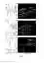 Fig. 31 - SYSTEM AND METHODS FOR IONIZING COMPOUNDS USING MATRIX-ASSISTANCE FOR MASS SPECTROMETRY AND ION MOBILITY SPECTROMETRY