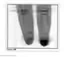 Fig. 24 - Methods and Compositions for Phototransfer