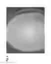 Fig. 06 - Deep MALDI TOF mass spectrometry of complex biological samples, e.g., serum, and uses thereof