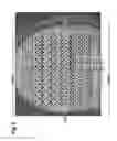 Fig. 08 - Deep MALDI TOF mass spectrometry of complex biological samples, e.g., serum, and uses thereof