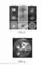 Fig. 04 - Method for correlating magnetic resonance images with histological sections