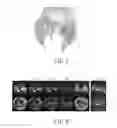 Fig. 06 - Method for correlating magnetic resonance images with histological sections