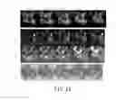Fig. 08 - Method for correlating magnetic resonance images with histological sections