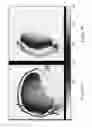 Fig. 08 - METHODS AND SYSTEMS RELATING TO HIGH RESOLUTION MAGNETIC RESONANCE IMAGING