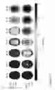 Fig. 10 - METHODS AND SYSTEMS RELATING TO HIGH RESOLUTION MAGNETIC RESONANCE IMAGING