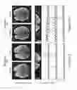 Fig. 12 - METHODS AND SYSTEMS RELATING TO HIGH RESOLUTION MAGNETIC RESONANCE IMAGING