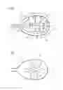 Fig. 02 - BODY-INSERTABLE DEVICE WITH AN MR COIL AND A SHIN COIL