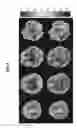 Fig. 10 - Signal inhomogeneity correction and performance evaluation apparatus