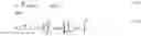 Fig. 12 - Optimal acoustic rake receiver