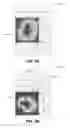 Fig. 04 - Multiscale method for reservoir models