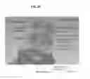 Fig. 03 - Rapid confocal microscopy to support surgical procedures