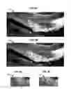 Fig. 06 - Rapid confocal microscopy to support surgical procedures