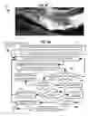 Fig. 07 - Rapid confocal microscopy to support surgical procedures