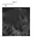 Fig. 15 - Rapid confocal microscopy to support surgical procedures