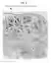 Fig. 16 - Rapid confocal microscopy to support surgical procedures