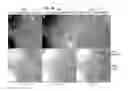 Fig. 23 - Rapid confocal microscopy to support surgical procedures