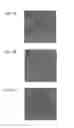 Fig. 07 - LENS ARRAY SUBSTRATE, ELECTRO-OPTIC DEVICE, AND ELECTRONIC APPARATUS