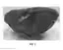 Fig. 04 - CAMERA COVER