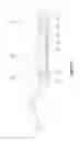 Fig. 10 - Hand motion-capturing device with force feedback system