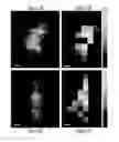 Fig. 28 - Multiplex analysis of molecules in single cells by image correlation