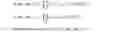 Fig. 14 - Detecting fetal sub-chromosomal aneuploidies