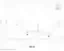 Fig. 32 - Detecting fetal sub-chromosomal aneuploidies