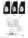 Fig. 04 - Method and X-ray system for computer aided detection of structures in X-ray images