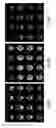 Fig. 07 - Vascular territory segmentation using mutual clustering information from image space and label space