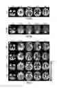 Fig. 08 - Vascular territory segmentation using mutual clustering information from image space and label space