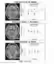 Fig. 19 - Systems and methods for generating biomarkers based on multivariate classification of functional imaging and associated data
